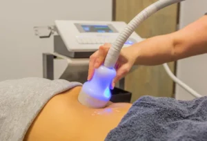 Cryotherapy TShock Cellulite Reduction Treatment